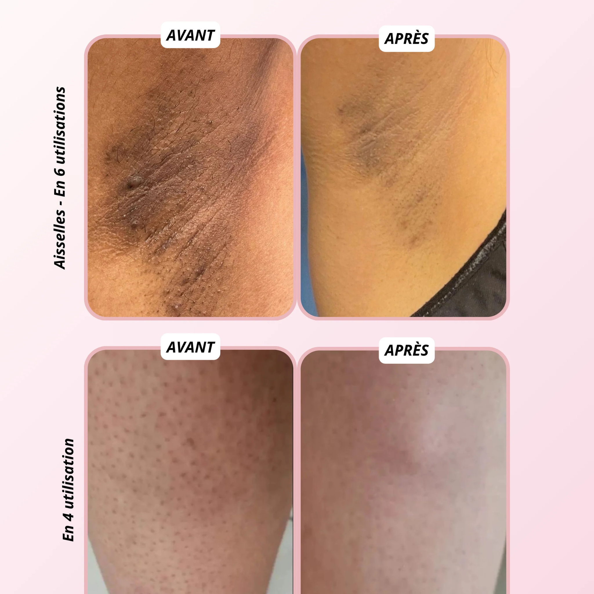 Gant exfoliant en soie