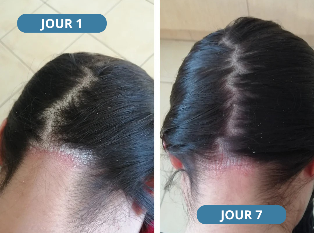 Novaderm® - Crème Apaisante Corps & Cuir Chevelu