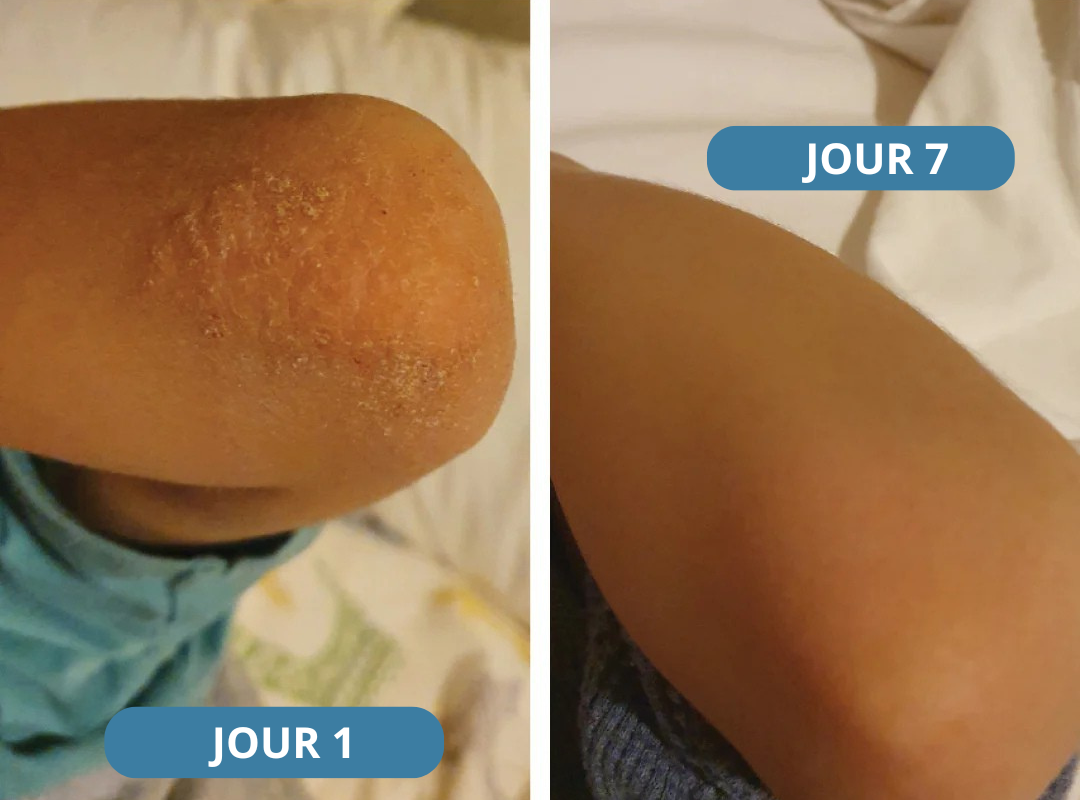 Novaderm® - Crème Apaisante Corps & Cuir Chevelu