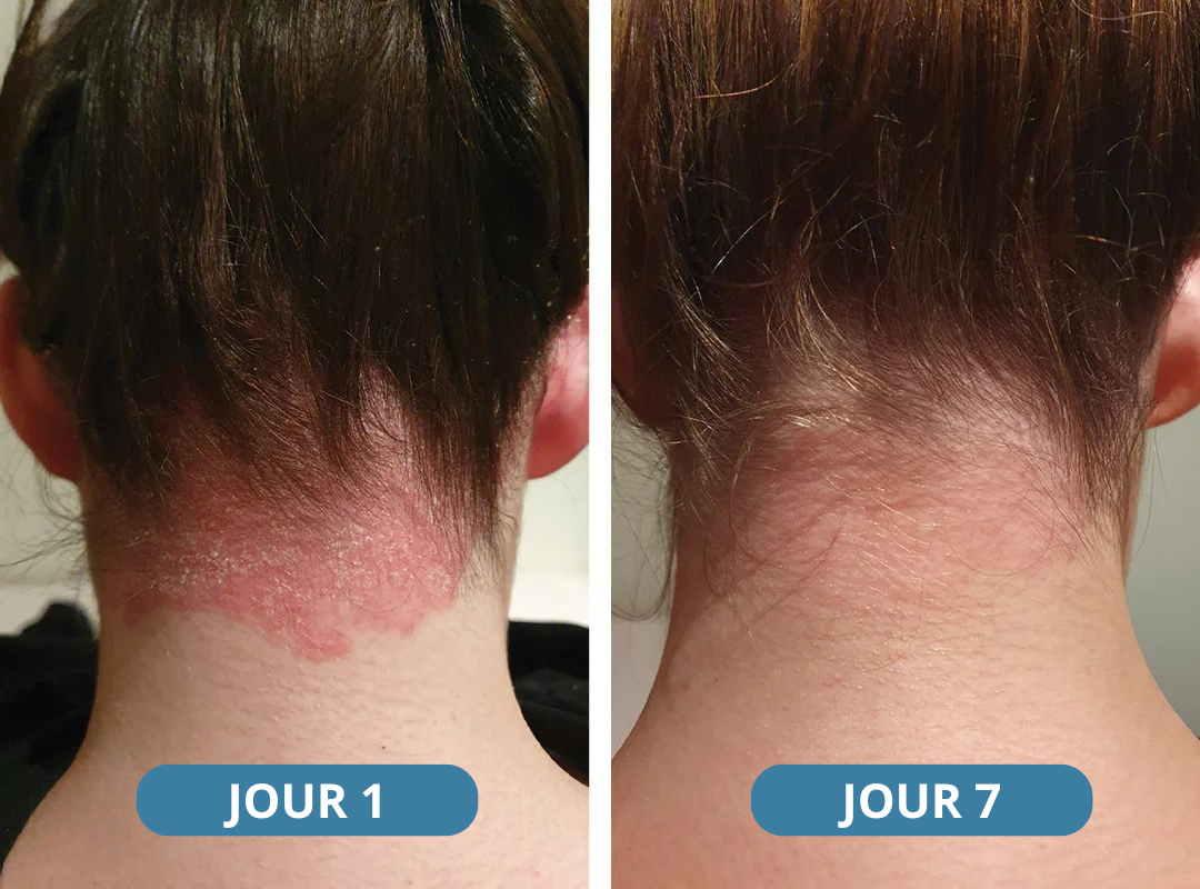 Novaderm® - Crème Apaisante Corps & Cuir Chevelu