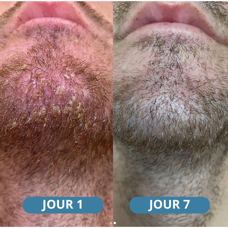 Novaderm® - Crème Apaisante Corps & Cuir Chevelu