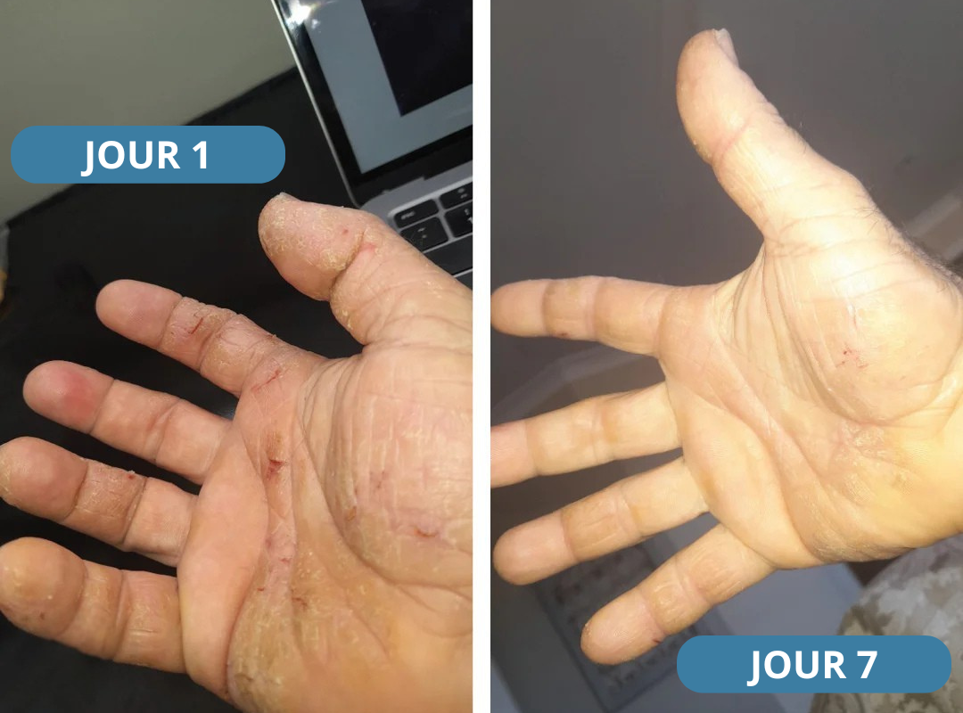 Novaderm® - Crème Apaisante Corps & Cuir Chevelu